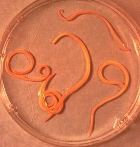 Parassiti dell'uomo ascarido