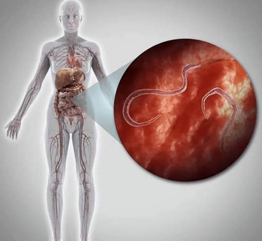 Parassiti nel corpo umano