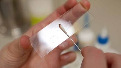 Analisi Calais per identificare i parassiti