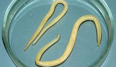 Come eseguire correttamente i test per l'ascariasi