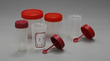 Come prepararsi alla prova dei parassiti