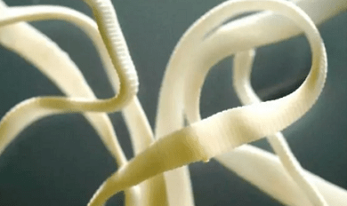Come rimuovere i parassiti dal corpo umano