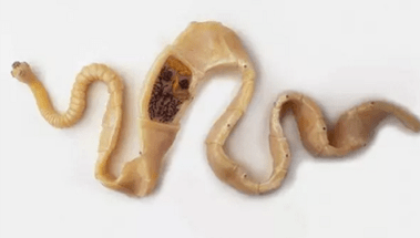 Come scoprire la presenza di parassiti nel corpo