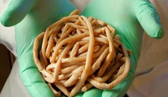 Rimozione dei parassiti dal corpo